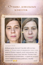 file 00000000f0b47243b15579a9125aafc0