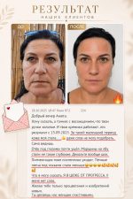 Luxury Women Golden Kit11