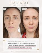 Luxury Women Golden Kit8