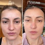 step 2 before after 1