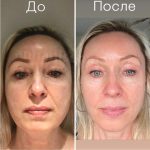step 2 before after 2
