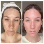 step 2 before after 3