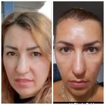 step 2 before after 4