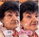 Quickwrinkle10