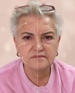 Quickwrinkle17