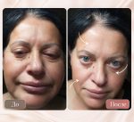 Quickwrinkle18