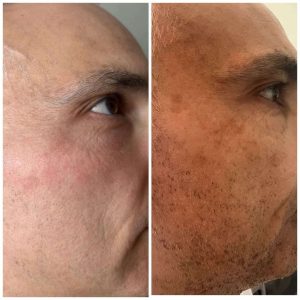before after 2