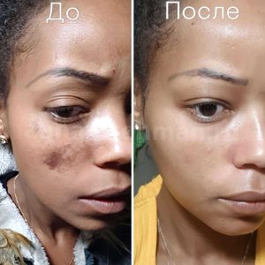 before after 3