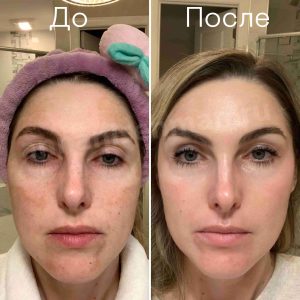 before after 5